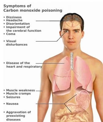 Chart of carbon monoxide toxicity symptoms