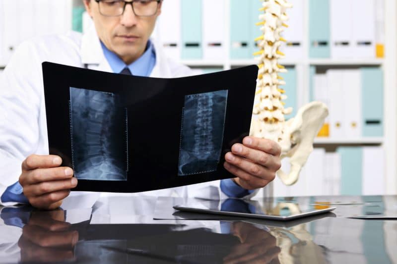 doctor looking at diagnostic test for spinal cord injury