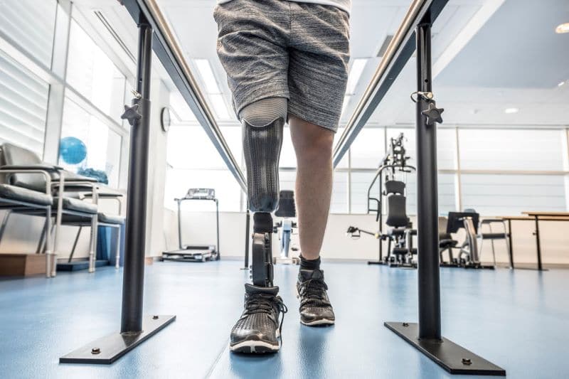 man doing physical therapy with a new prosthetic leg