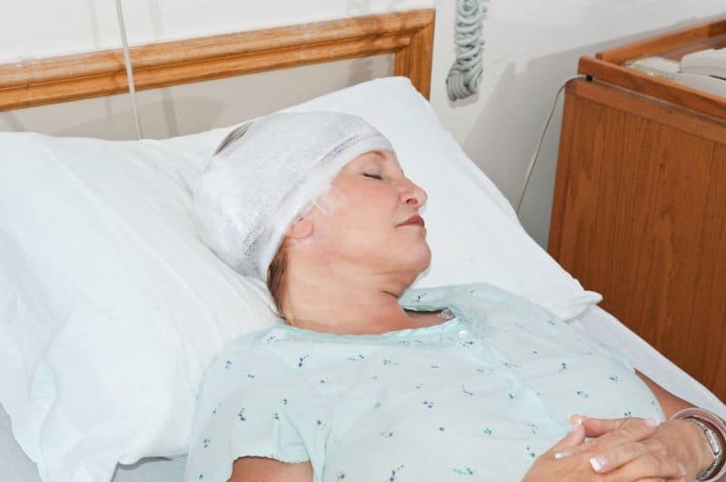 woman patient in a coma with a brain injury