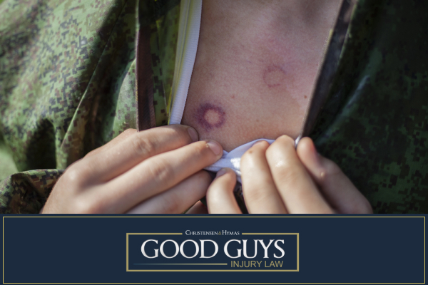 Common injuries caused by paintball gun discharges